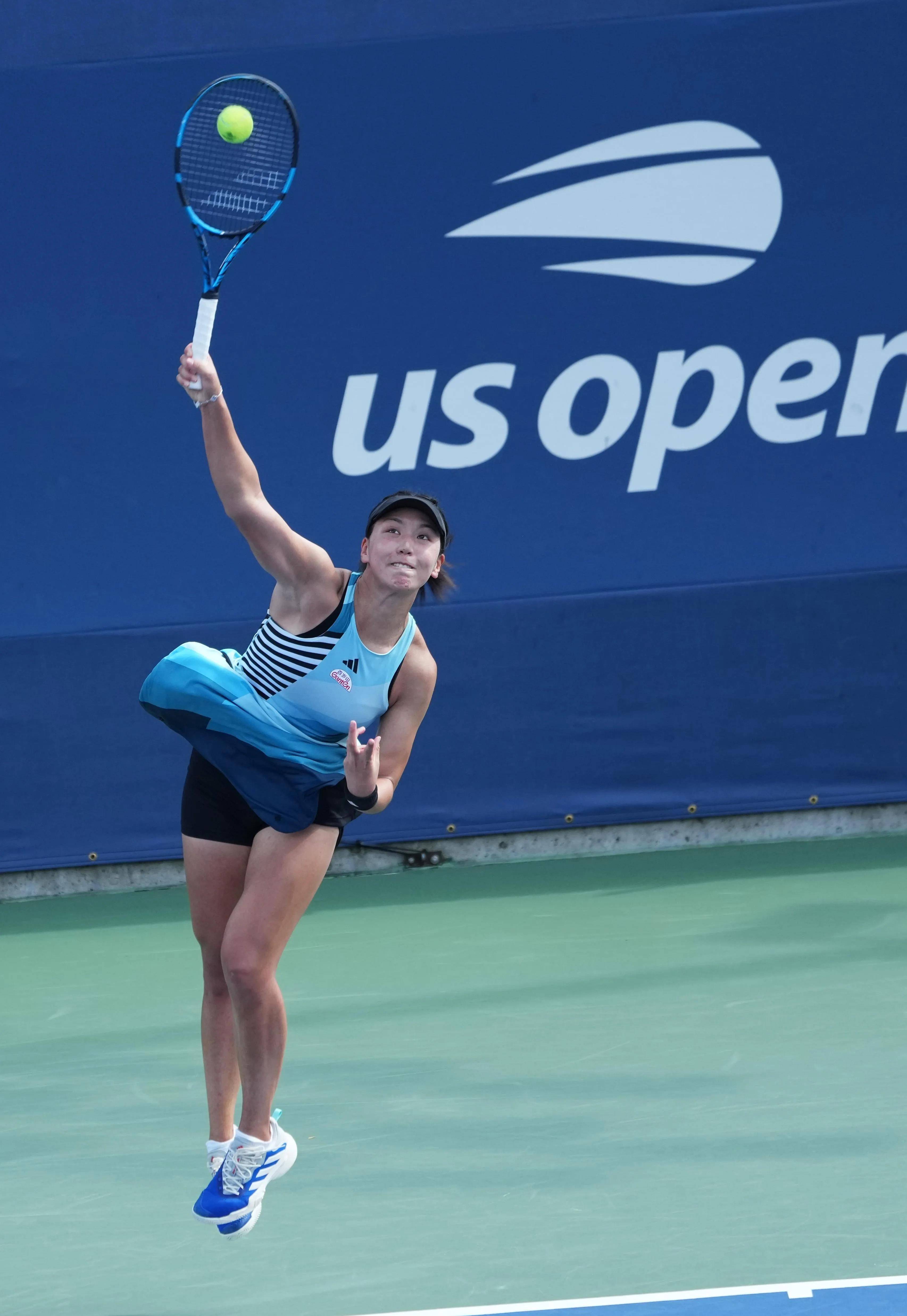 回购条款 回购条款